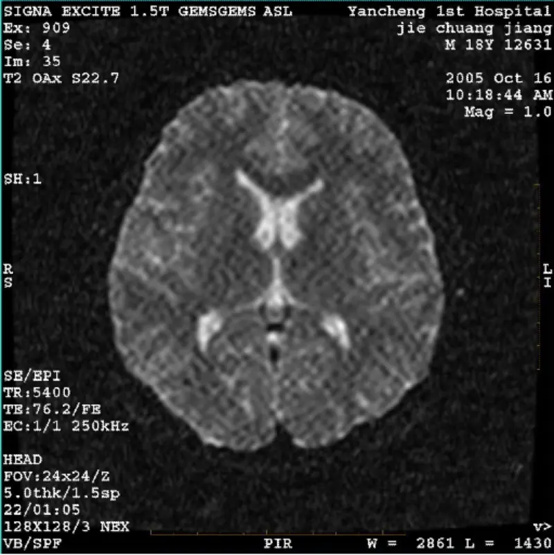 आर्टिफ़ैक्ट WI/फ़िएस्टा छवि सफ़ेद पिक्सेल